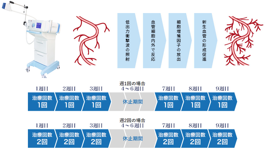 Plan⑩：ED(勃起不全)根本治療