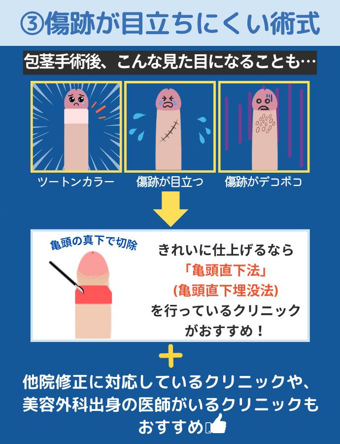 傷跡が目立ちにくい術式を採用している