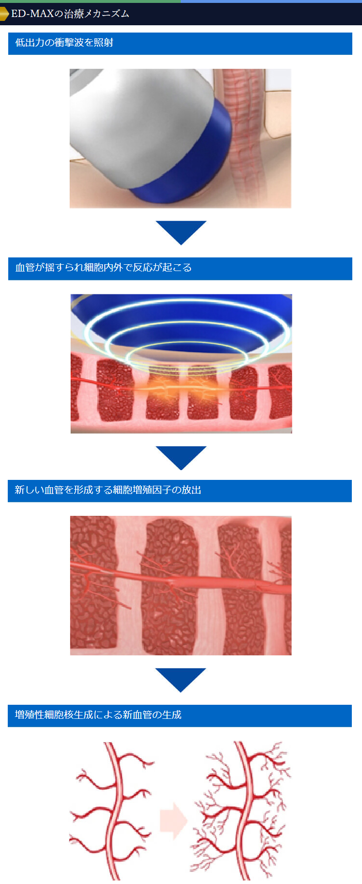 衝撃波治療器