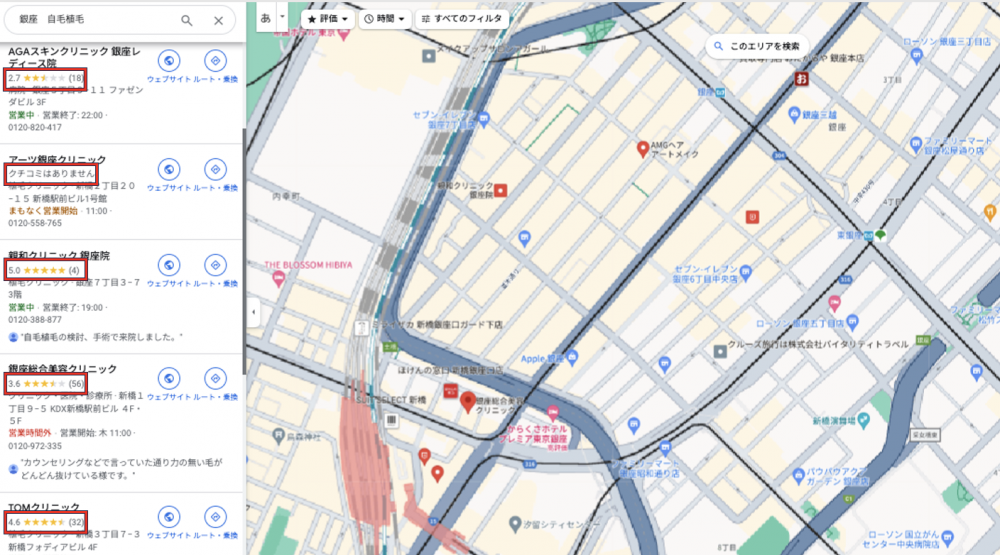 銀座　自毛植毛マップ