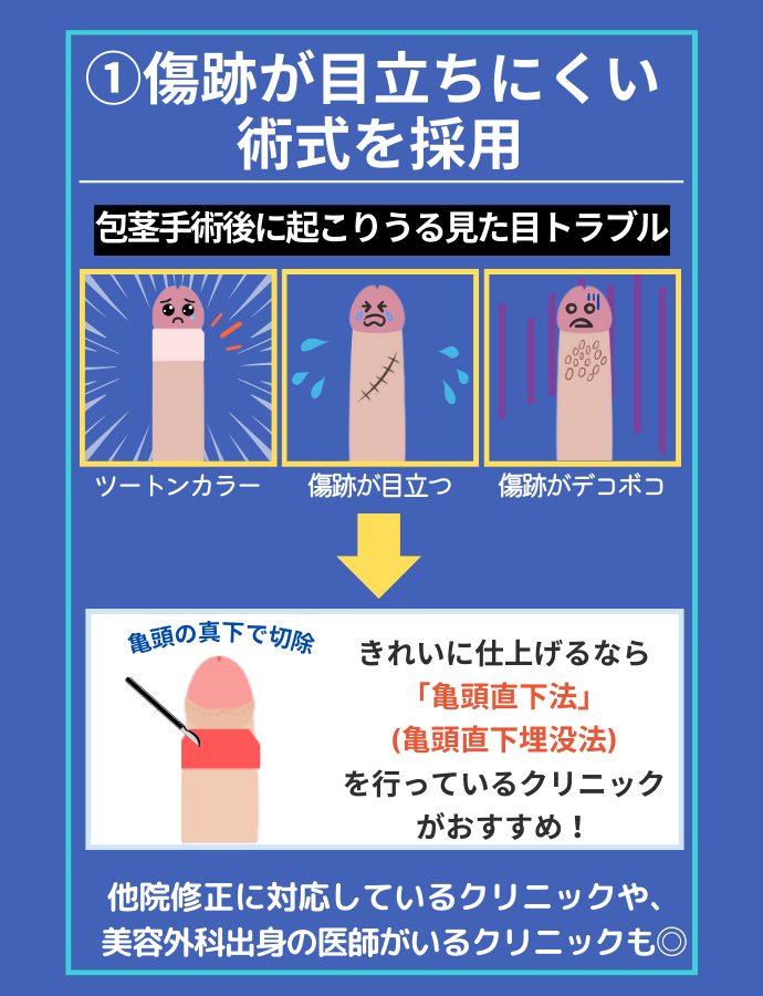 傷跡が目立ちにくい術式を採用