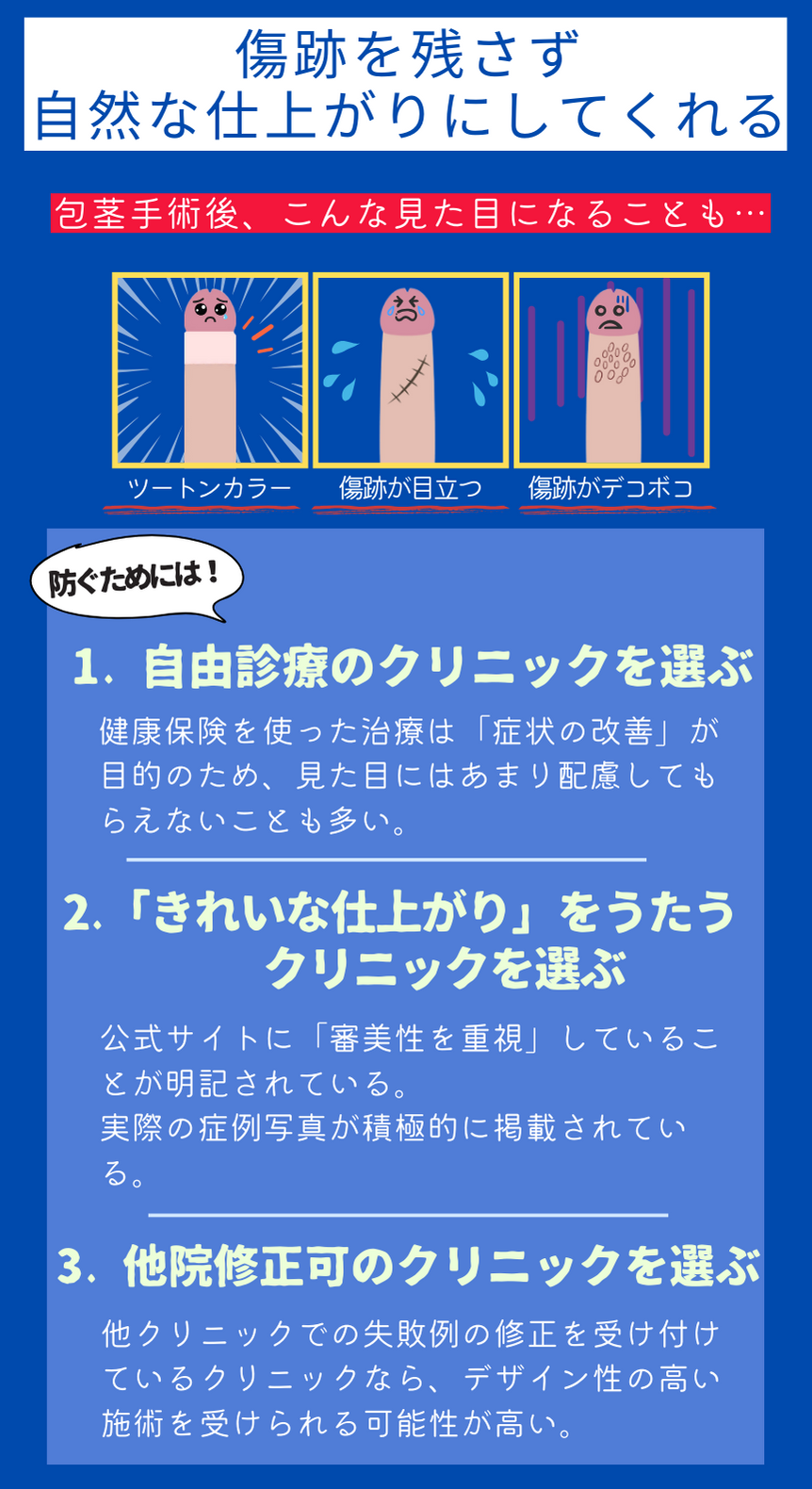 包茎手術の失敗例と防ぐポイント