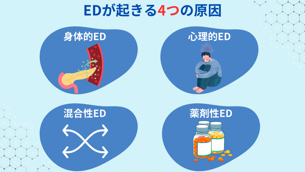 EDが起きる4つの原因