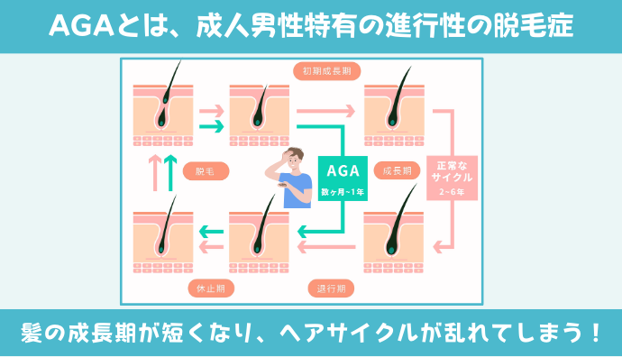 AGAは「ヘアサイクルの乱れ」から起こる脱毛症