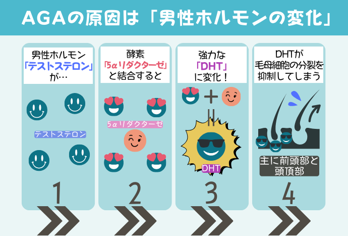 AGAの原因は「DHT(ジヒドロテストステロン)」！遺伝的要因も