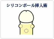 東京ノーストクリニックのシリコンボール挿入術